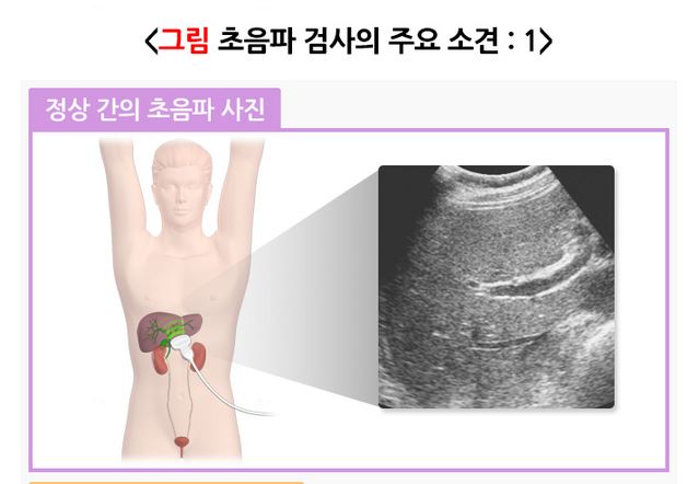 복부초음파검사 | 국민건강지식센터